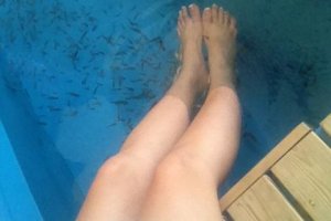 Doctor Fish Therapy